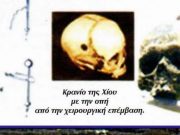 Λεπτή Εγχείρηση Εγκεφάλου στην Αρχαία Χίο το 250 π.Χ.