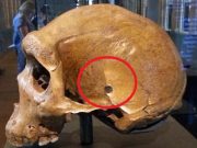 «Τρύπα από σφαίρα» σε κρανίο άνω 25.000 ετών; Το μυστήριο του Rhodesian Man «Τρύπα από σφαίρα» σε κρανίο άνω 25.000 ετών; Το μυστήριο του Rhodesian Man