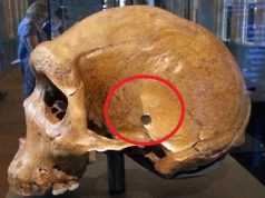 «Τρύπα από σφαίρα» σε κρανίο άνω 25.000 ετών; Το μυστήριο του Rhodesian Man «Τρύπα από σφαίρα» σε κρανίο άνω 25.000 ετών; Το μυστήριο του Rhodesian Man