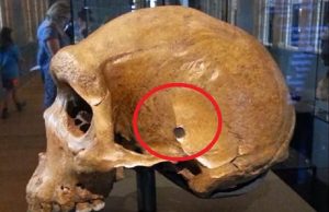 «Τρύπα από σφαίρα» σε κρανίο άνω 25.000 ετών; Το μυστήριο του Rhodesian Man «Τρύπα από σφαίρα» σε κρανίο άνω 25.000 ετών; Το μυστήριο του Rhodesian Man