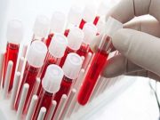 Γιατί είναι ξεχωριστοί όσοι έχουν Ομάδα Αίματος 0 μηδέν