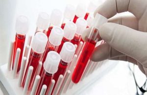 Γιατί είναι ξεχωριστοί όσοι έχουν Ομάδα Αίματος 0 μηδέν