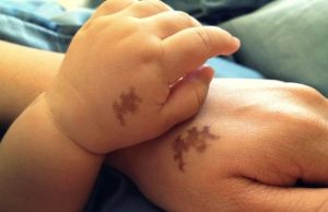 Τα σημάδια εκ γενετής και η καρμική τους ερμηνεία Τα σημάδια εκ γενετής και η καρμική τους ερμηνεία