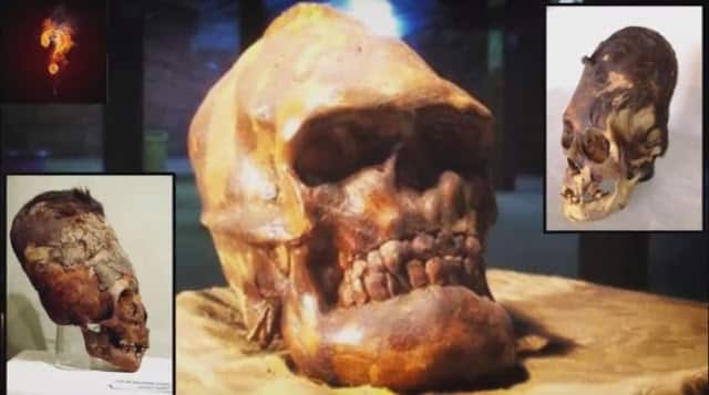 Αρχαίοι γίγαντες βρέθηκαν θαμμένοι στην Αλάσκα;