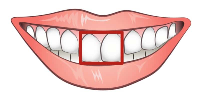 ΤΙ ΔΕΙΧΝΟΥΝ τα Μπροστινά Δόντια σας για τον Χαρακτήρα σας