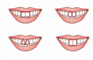 Τι δείχνουν τα μπροστινά δόντια μας για τον χαρακτήρα μας