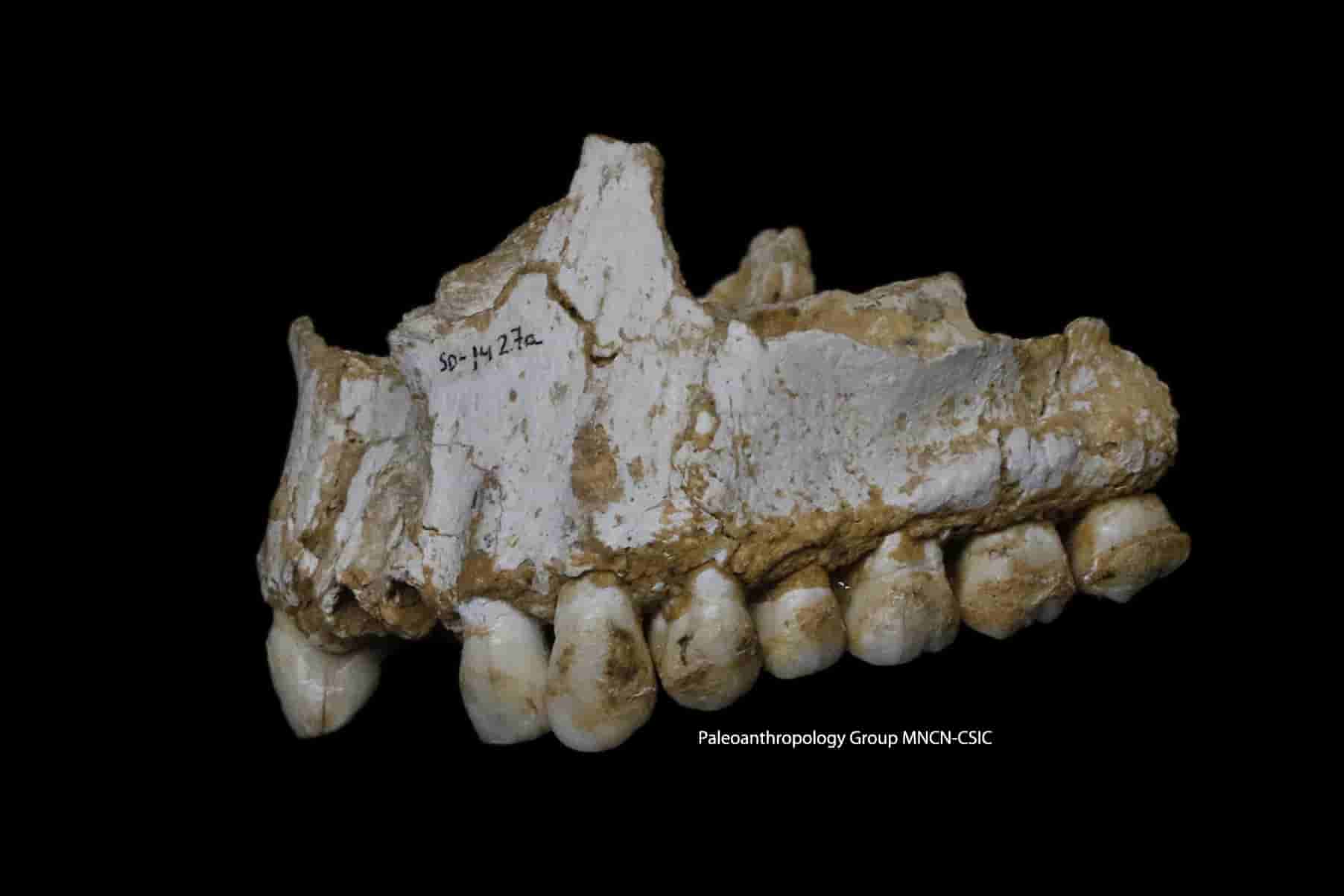 Ανέλυσαν DNA από Οδοντοστοιχία Νεάντερταλ ΟΜΩΣ Αυτό που Βρήκαν Ανάμεσα στα Δόντια Ξάφνιασε τους Επιστήμονες